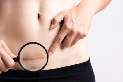 Nr. pavadinimo projektas (46) Easy Resize.com