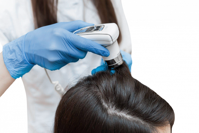 VIP trichologinė procedūra